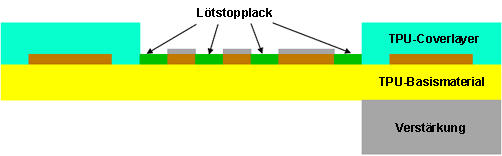 Querschnitt-Aufbau einer einseitigen dehnbaren Leiterplatte (TPU) mit lokaler Verstärkung.